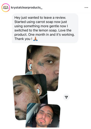 Face & Body Toner Acne Soap