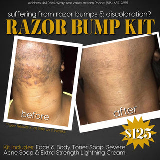 Razor Bump Kit